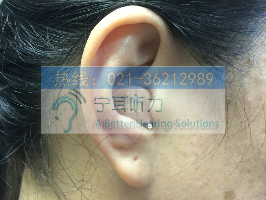 供应瑞声达隐形助听器百年品牌上海入死的助听器专卖店
