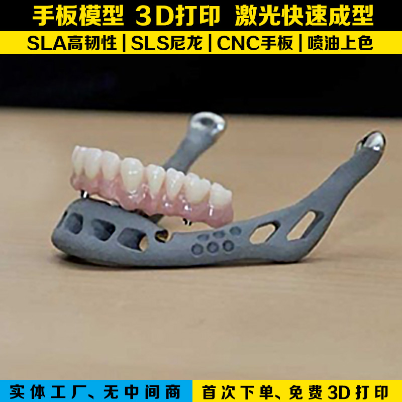 深圳手板模型3d打印假牙模型批发